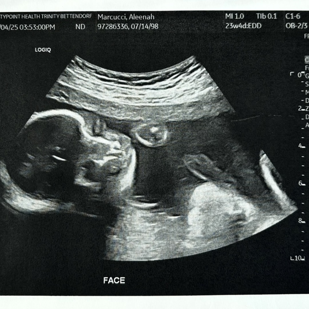 Photo shared by Aleenah for their Babylist baby registry.