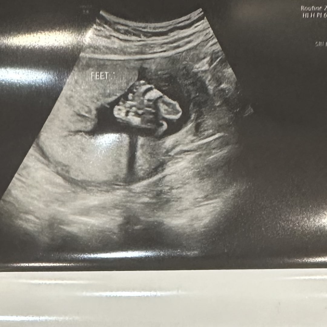 Photo shared by Kelly for their Babylist baby registry.
