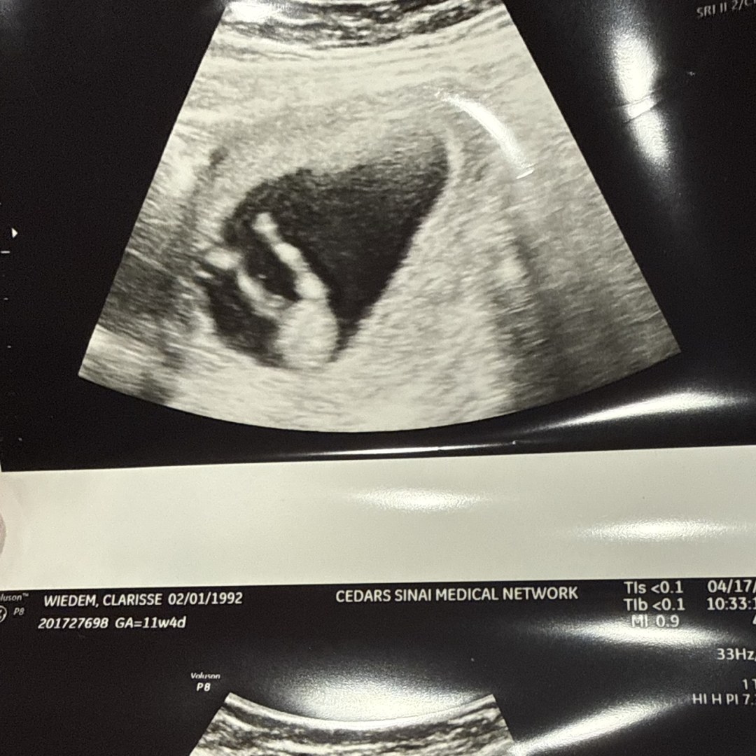 Photo shared by Clarisse for their Babylist baby registry.