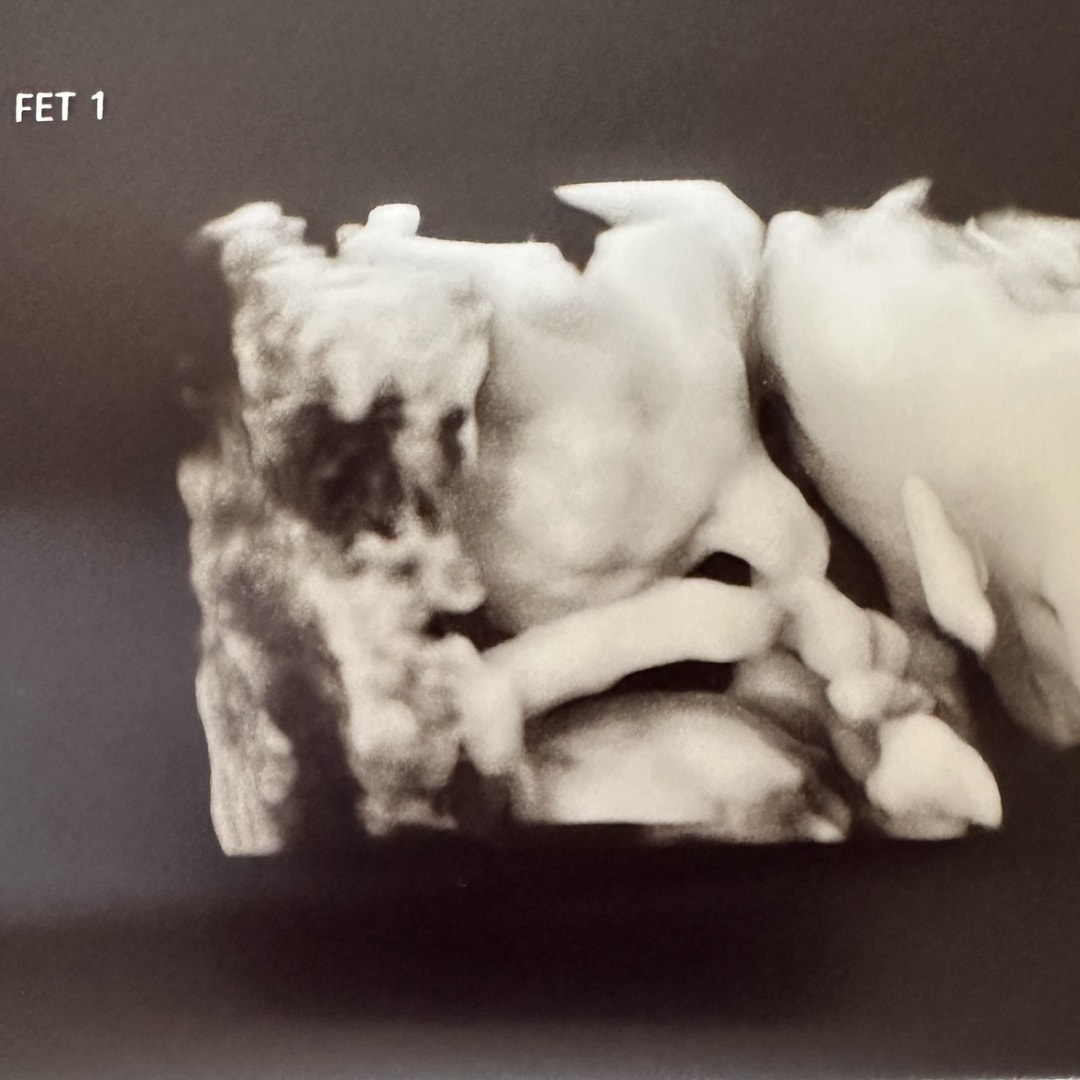 Photo shared by Joscelyn for their Babylist baby registry.