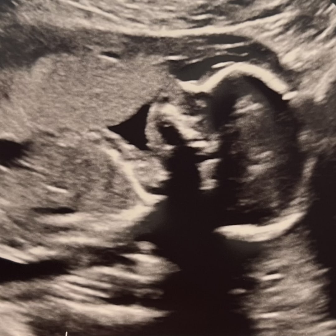 Photo shared by McKayla for their Babylist baby registry.