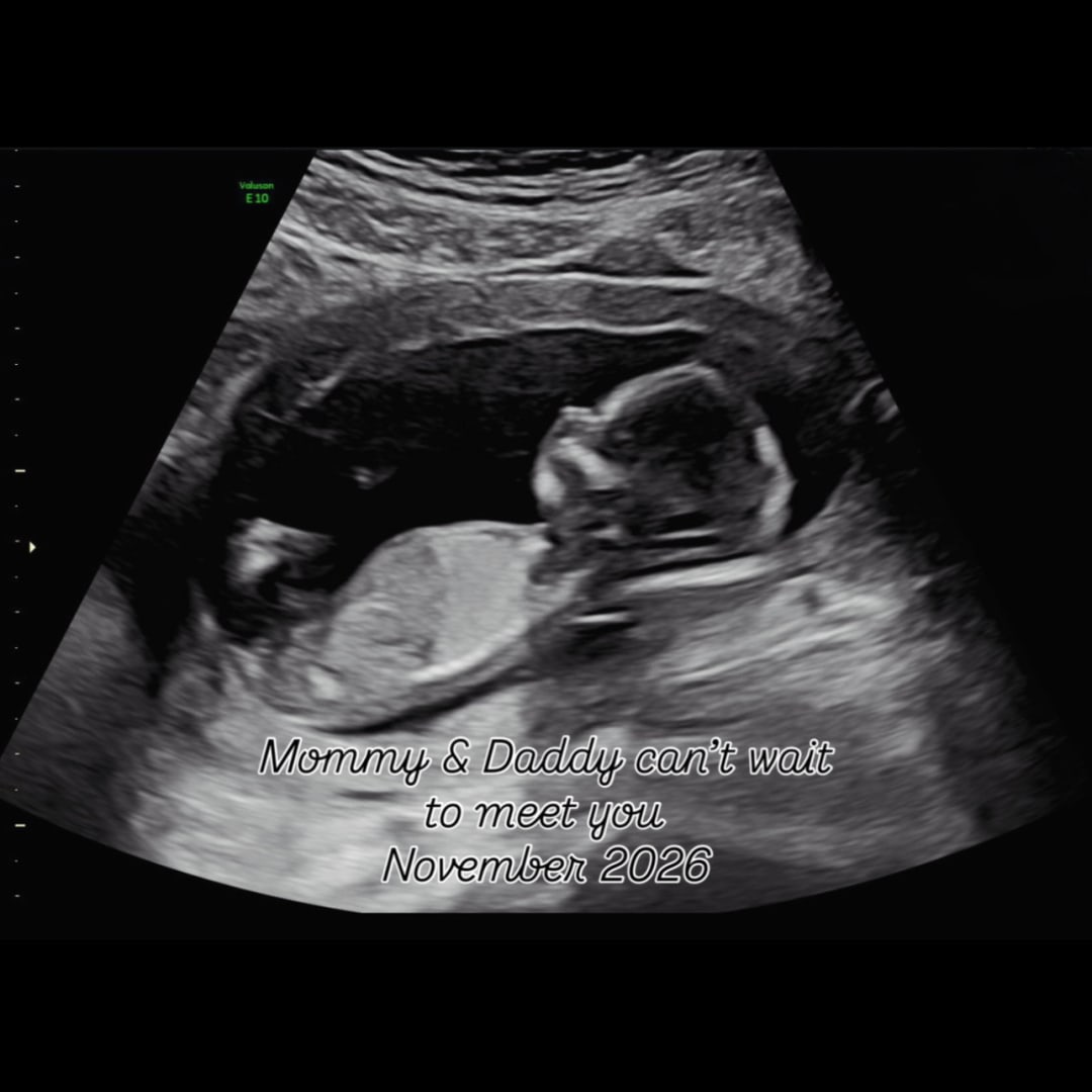 Photo shared by Jane for their Babylist baby registry.