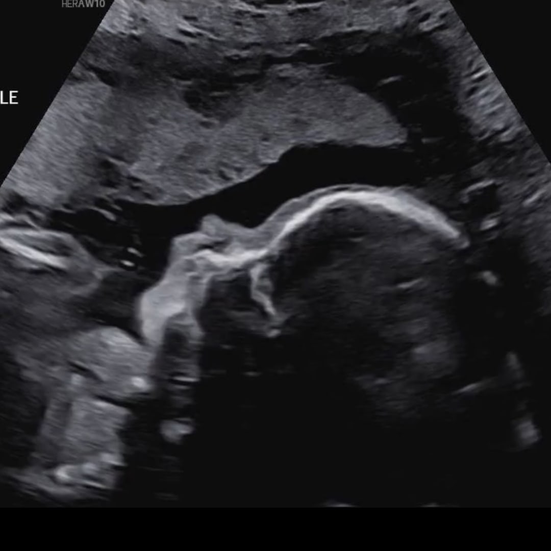 Photo shared by Shelby for their Babylist baby registry.