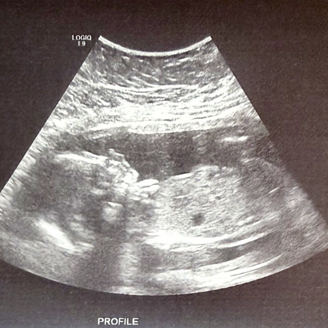 Photo shared by Kristi for their Babylist baby registry.