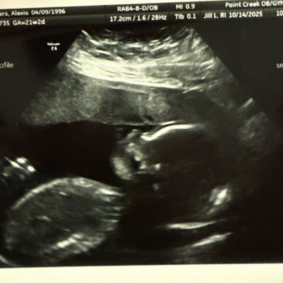 Photo shared by Alexis for their Babylist baby registry.