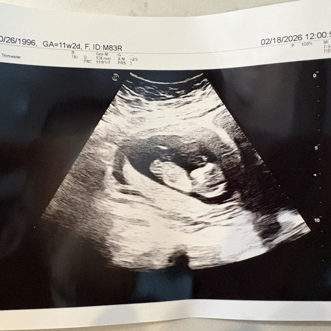 Photo shared by Emily for their Babylist baby registry.