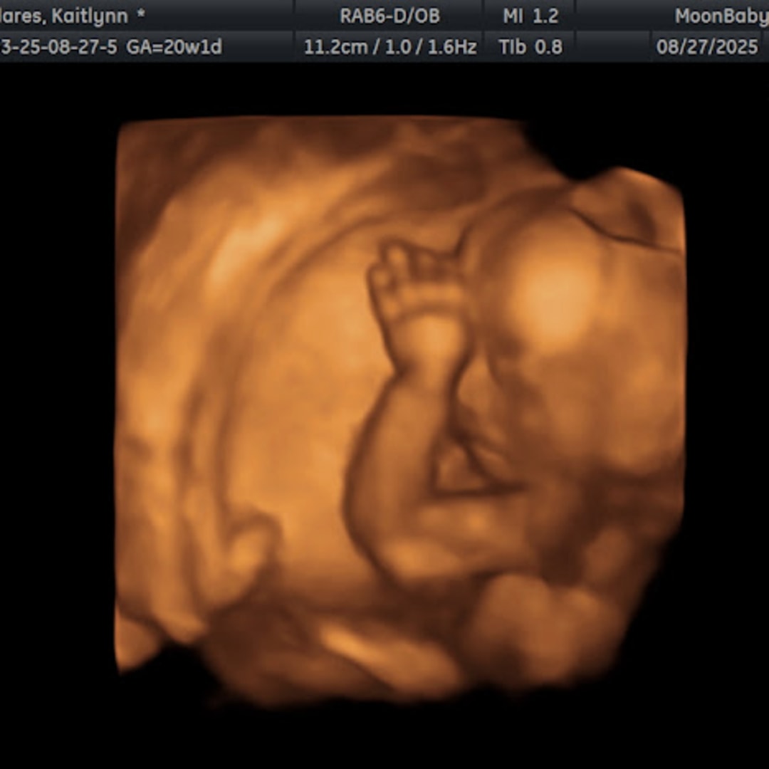 Photo shared by Kaitlynn for their Babylist baby registry.