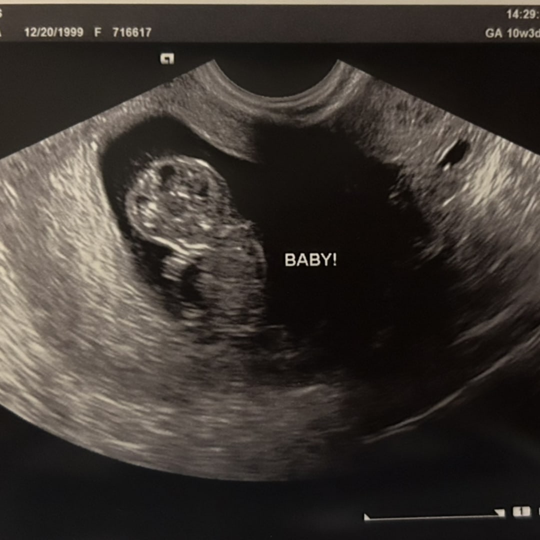 Photo shared by Johny for their Babylist baby registry.