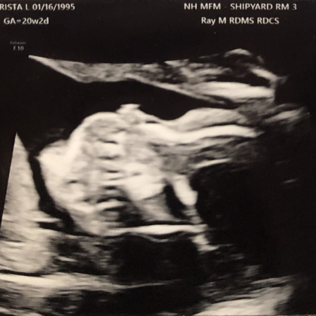 Photo shared by Krista for their Babylist baby registry.