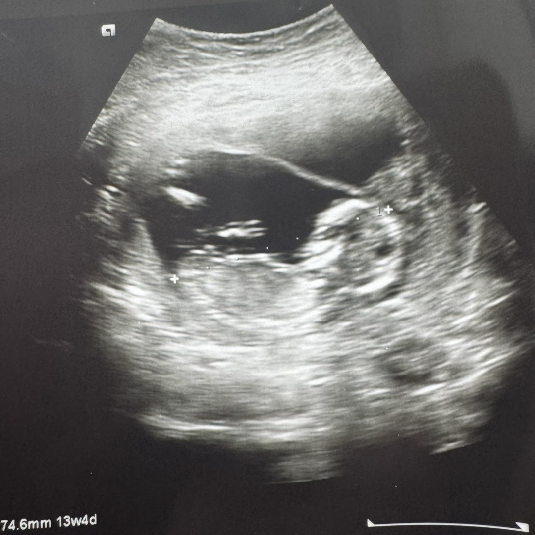 Photo shared by Haley for their Babylist baby registry.
