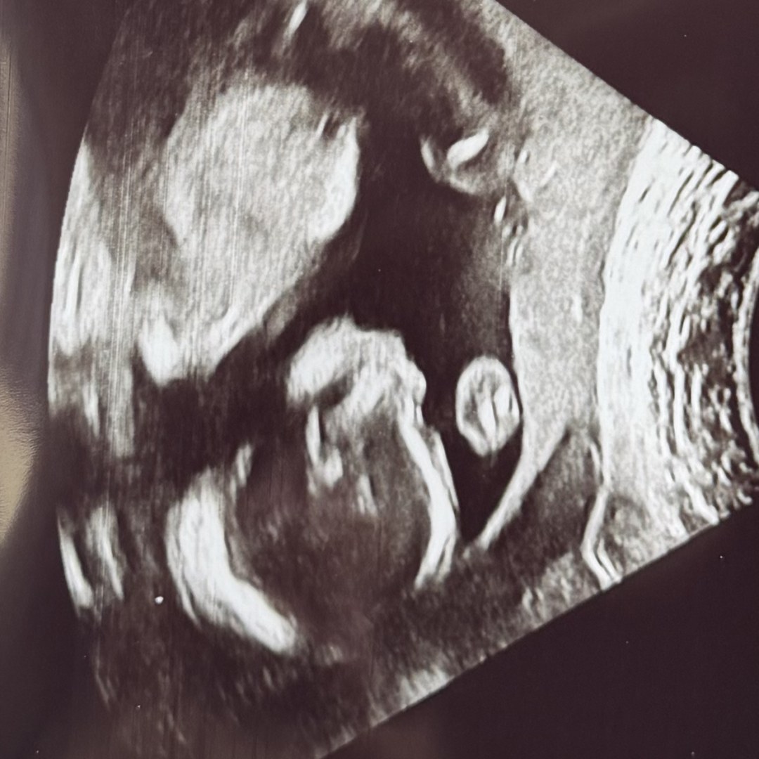 Photo shared by Lizbeth for their Babylist baby registry.