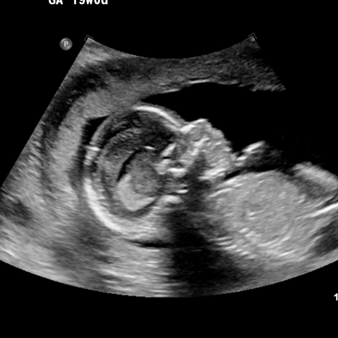 Photo shared by Ashley for their Babylist baby registry.