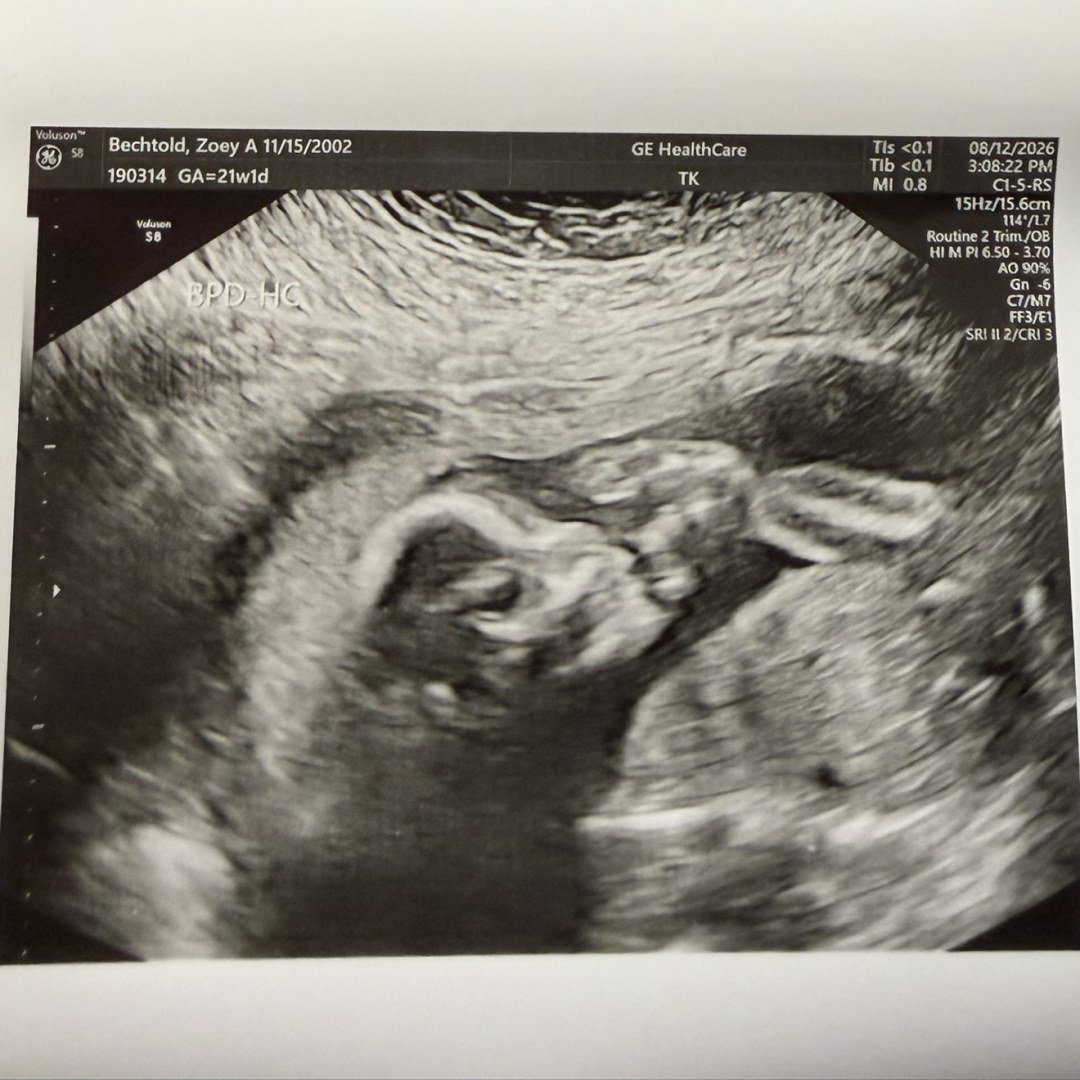 Photo shared by Zoey for their Babylist baby registry.