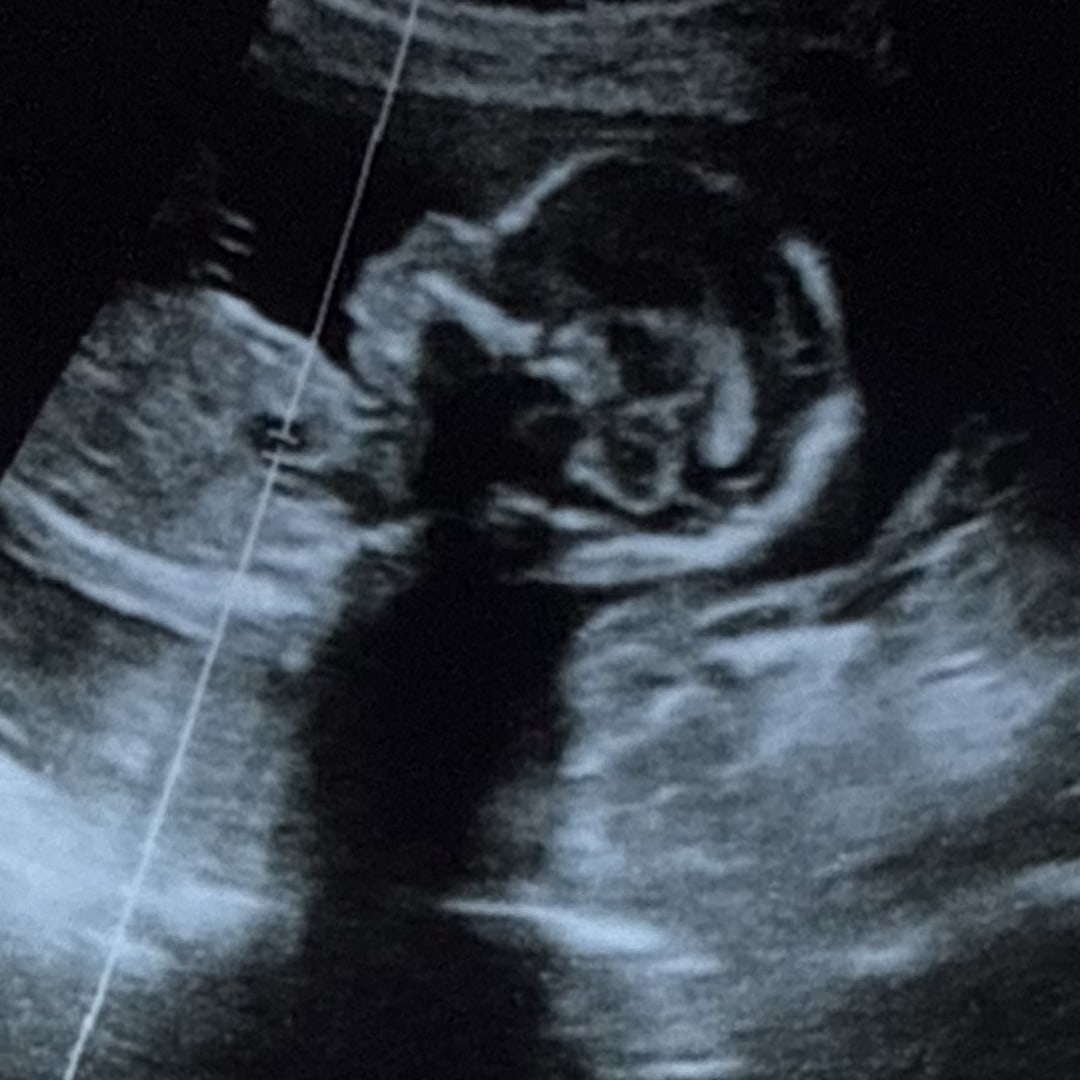 Photo shared by Christina-Alexha for their Babylist baby registry.