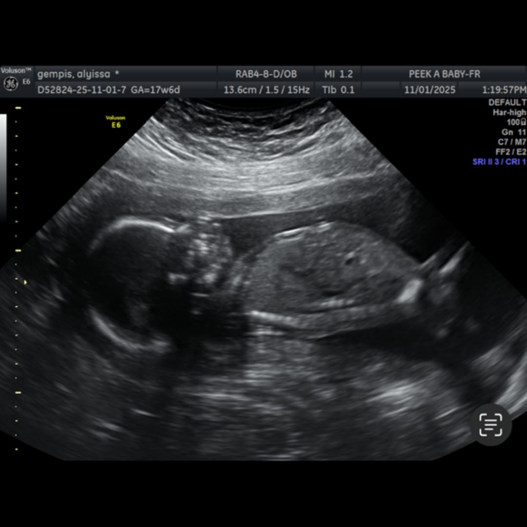 Photo shared by Alyissa for their Babylist baby registry.