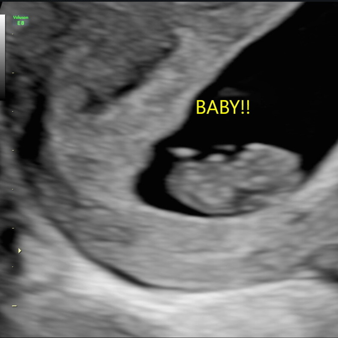 Photo shared by Samantha for their Babylist baby registry.