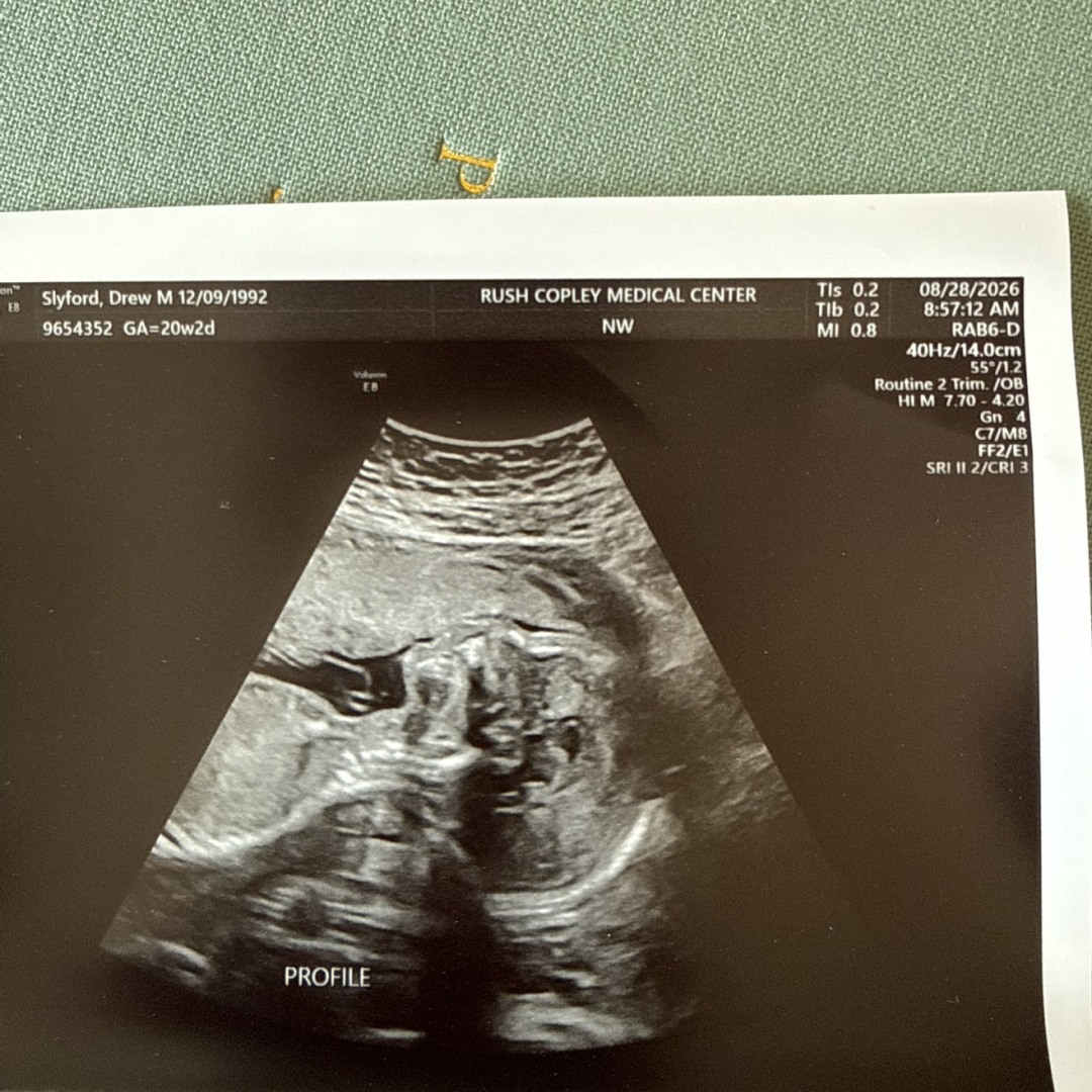 Photo shared by Drew for their Babylist baby registry.