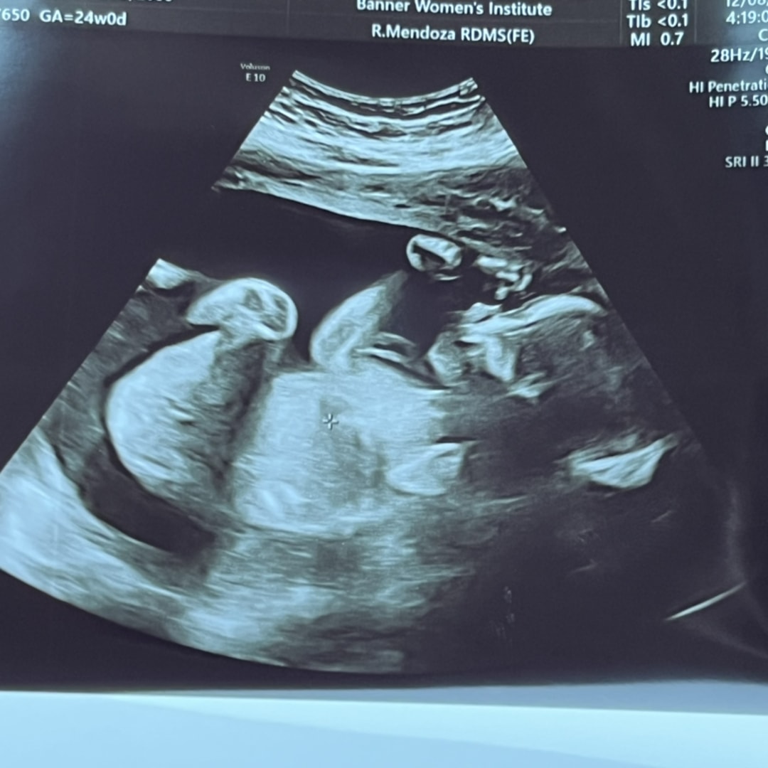 Photo shared by Kelsey for their Babylist baby registry.