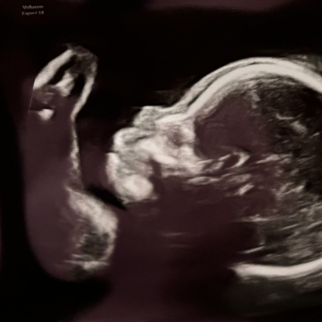 Photo shared by Ebony for their Babylist baby registry.