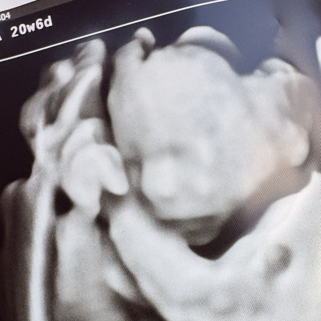 Photo shared by Savannah for their Babylist baby registry.