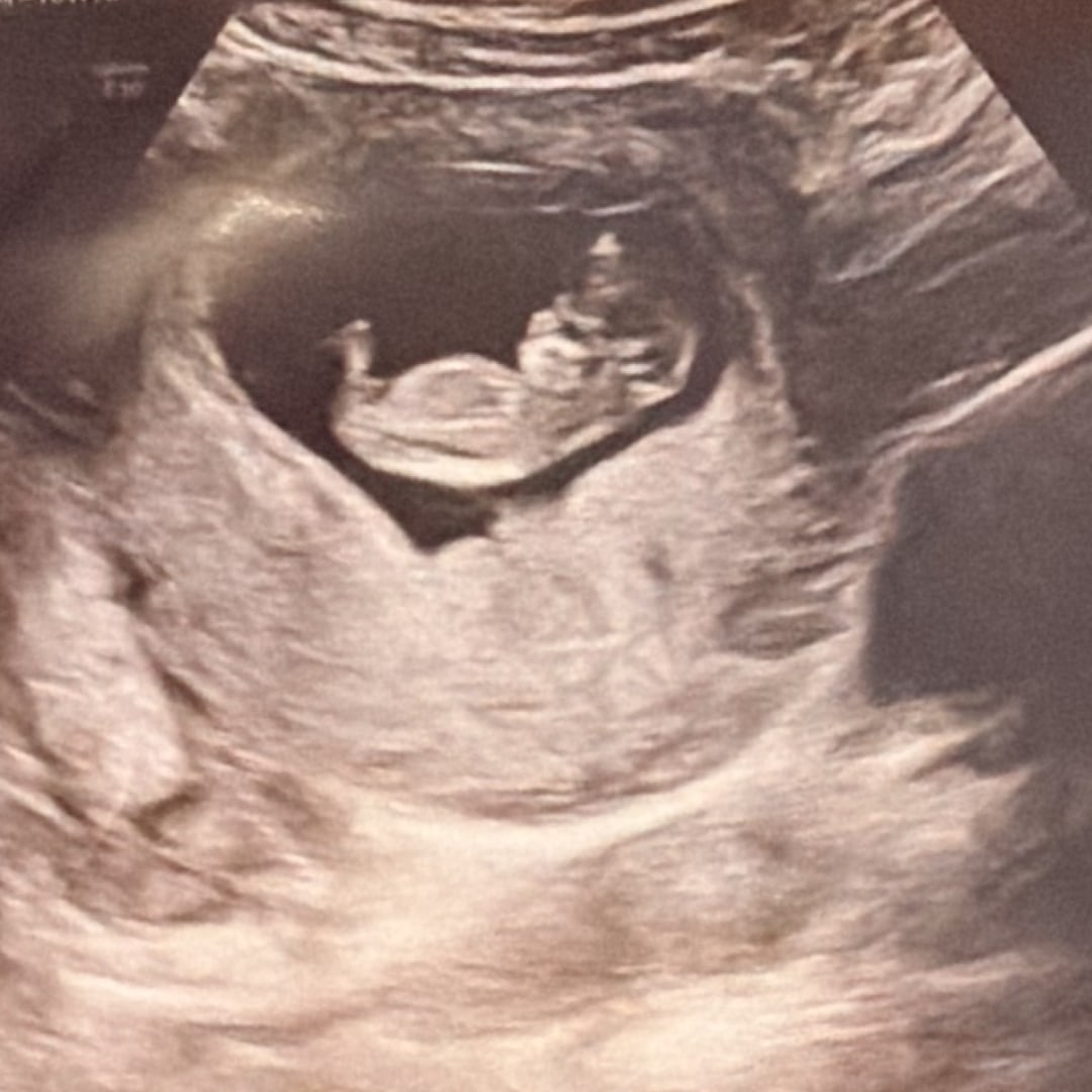 Photo shared by Giselle for their Babylist baby registry.