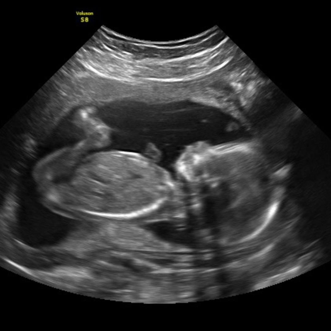 Photo shared by Alan for their Babylist baby registry.