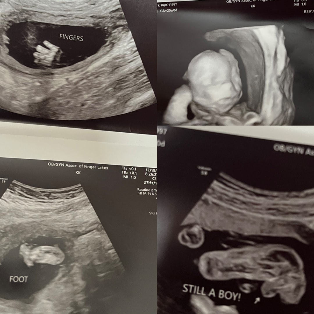 Photo shared by Alyx for their Babylist baby registry.