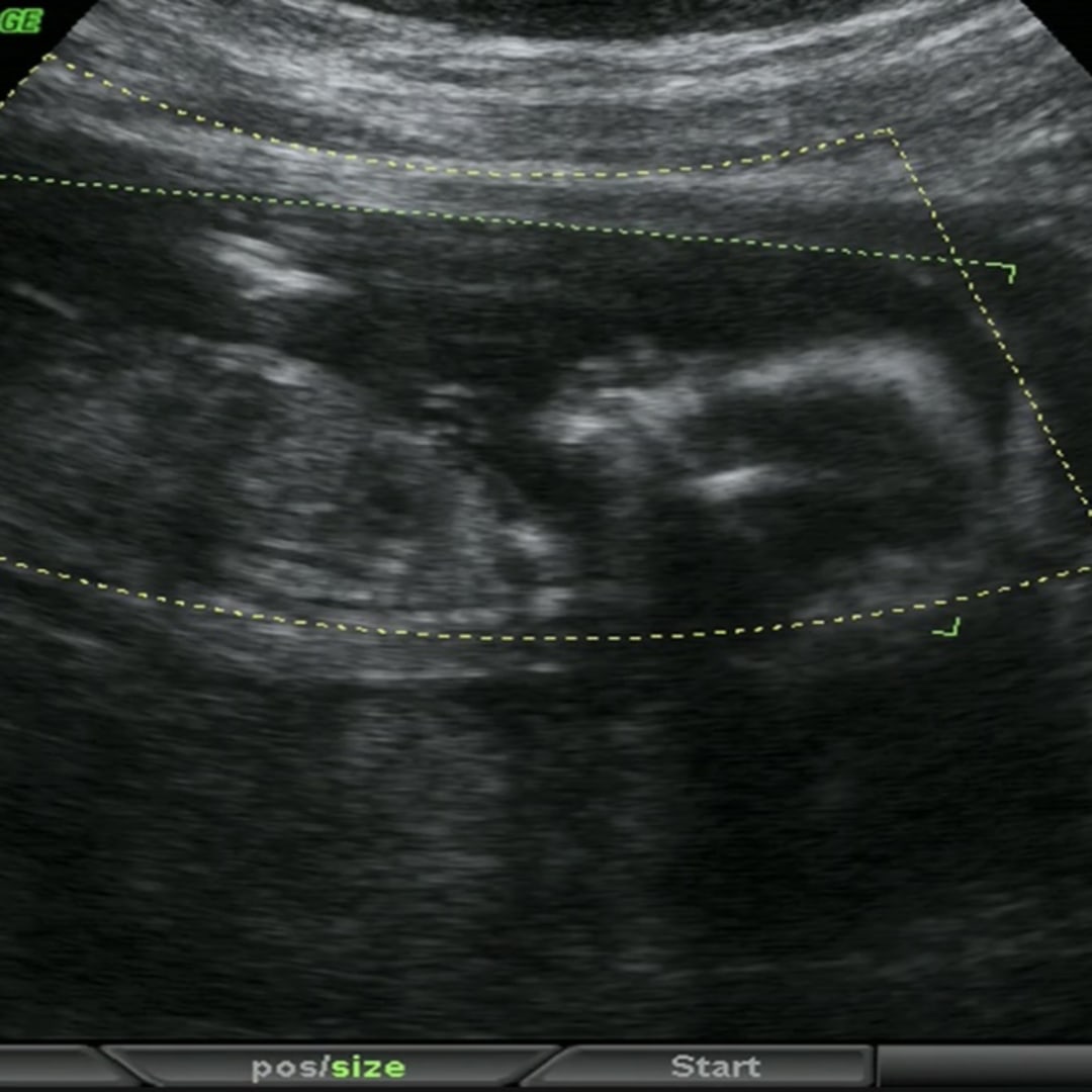 Photo shared by Hannah for their Babylist baby registry.