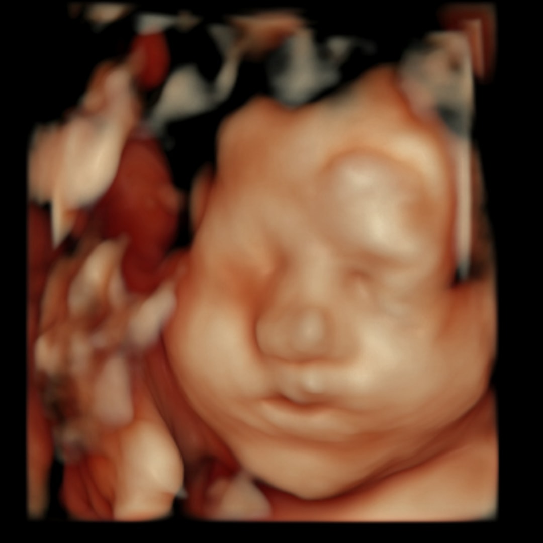 Photo shared by Hannah for their Babylist baby registry.