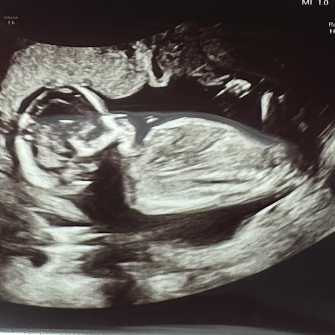 Photo shared by Amanda for their Babylist baby registry.