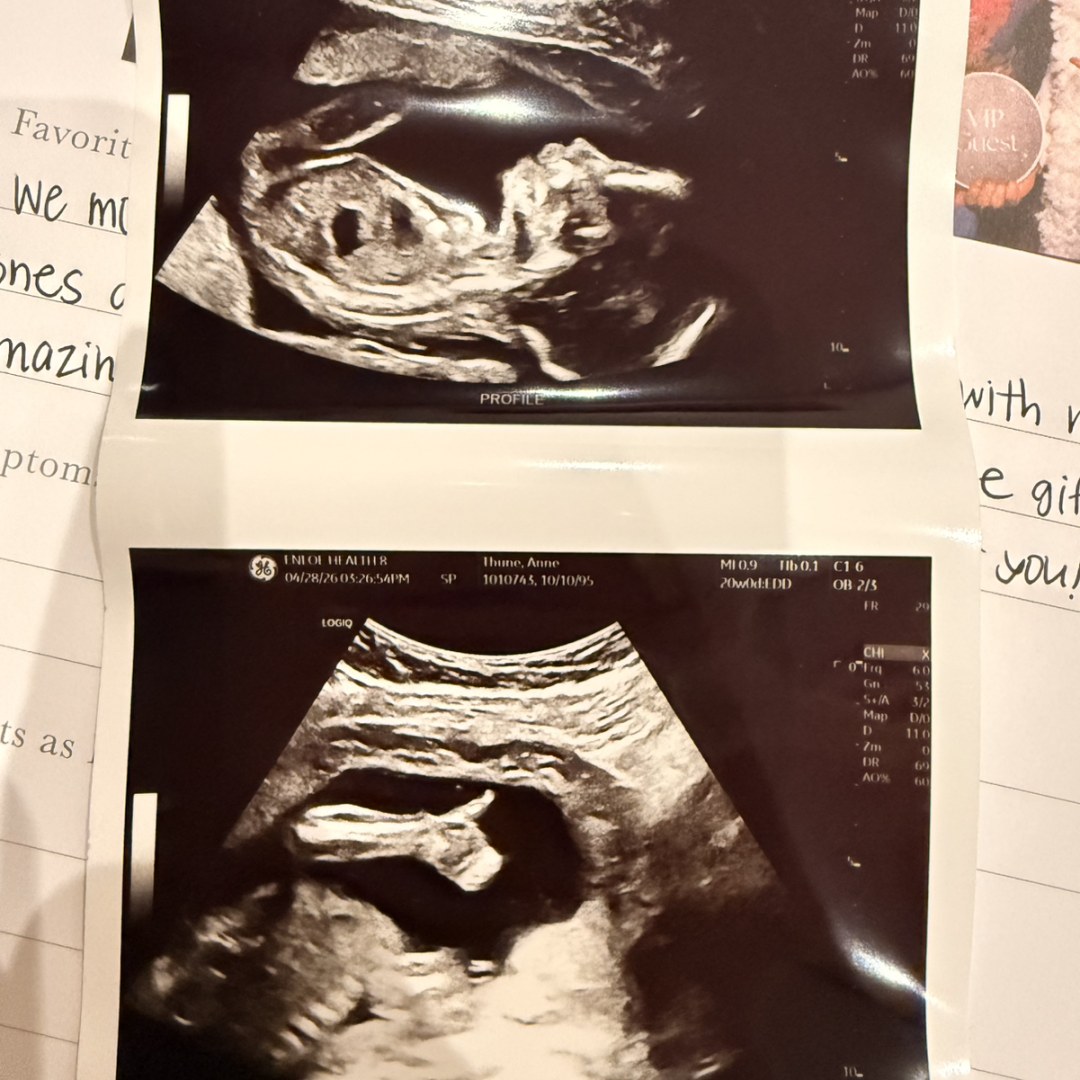 Photo shared by Annie for their Babylist baby registry.