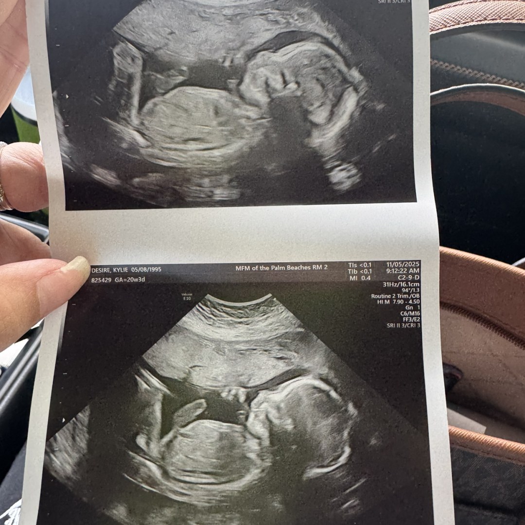 Photo shared by Kylie for their Babylist baby registry.