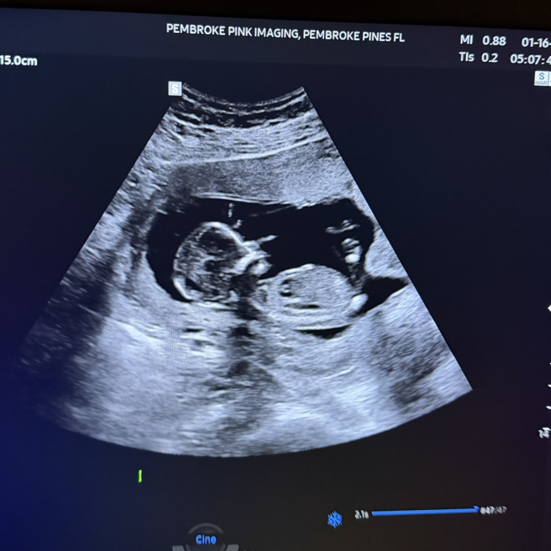 Photo shared by Alejandra for their Babylist baby registry.