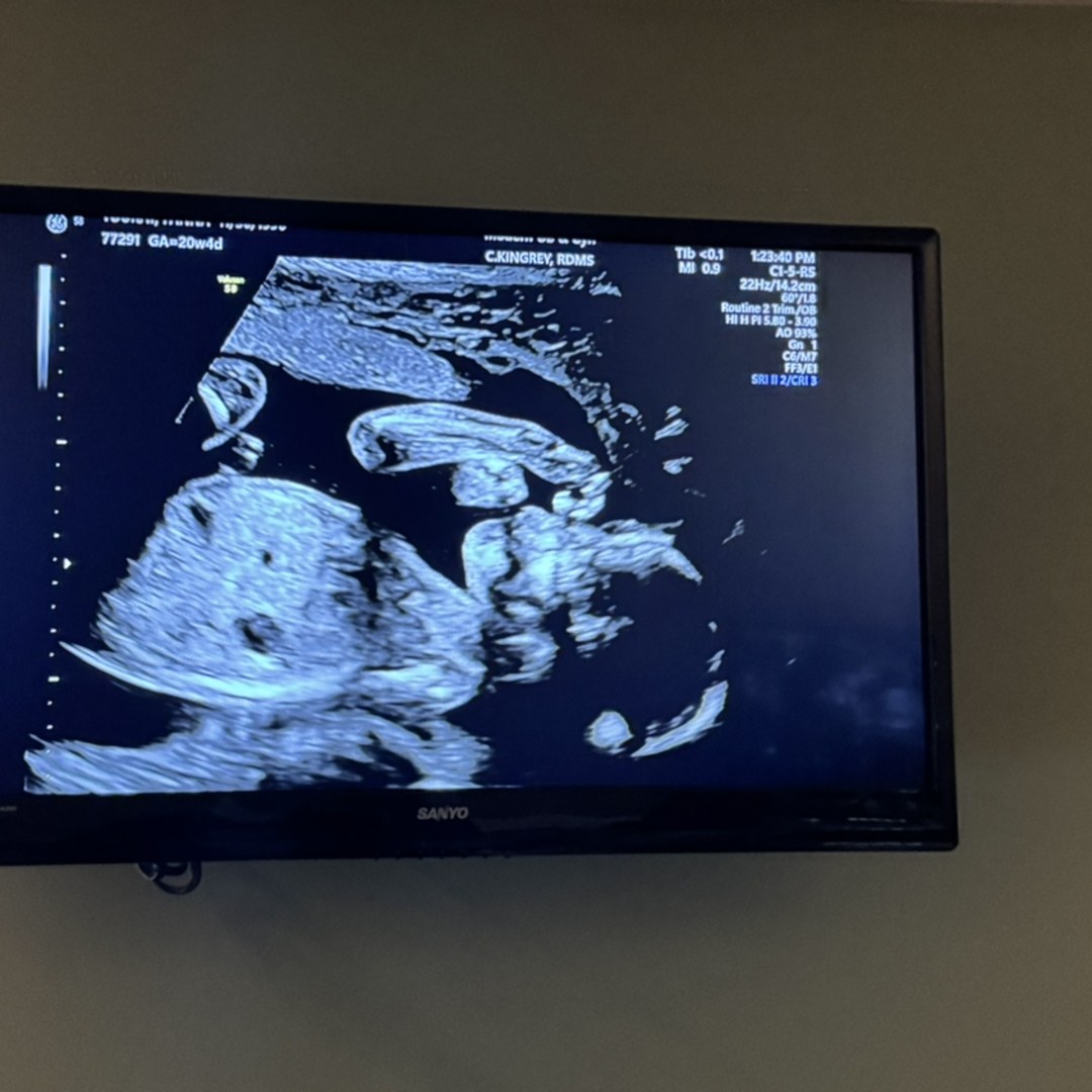 Photo shared by Fanna for their Babylist baby registry.