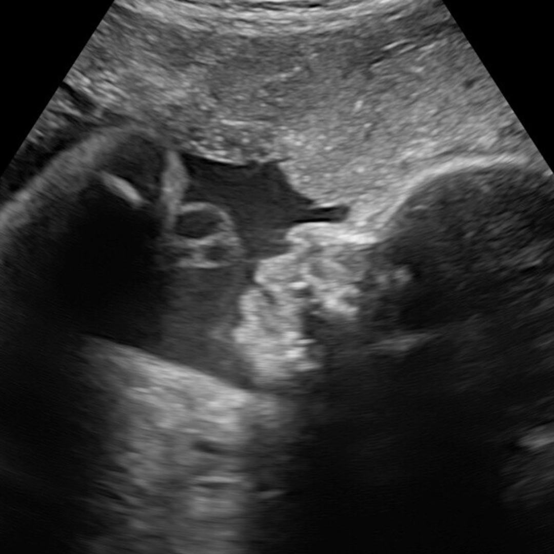 Photo shared by Jenny for their Babylist baby registry.