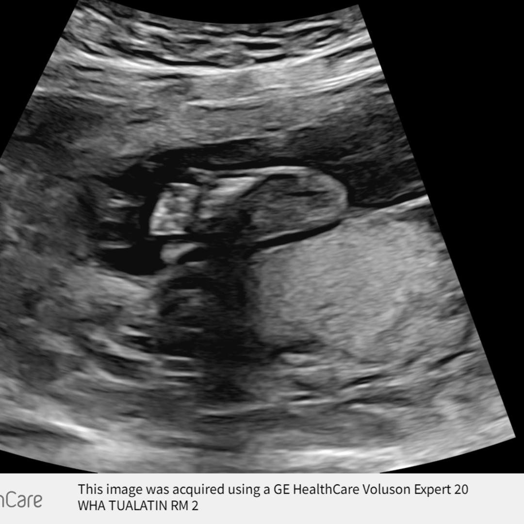 Photo shared by Maddie for their Babylist baby registry.