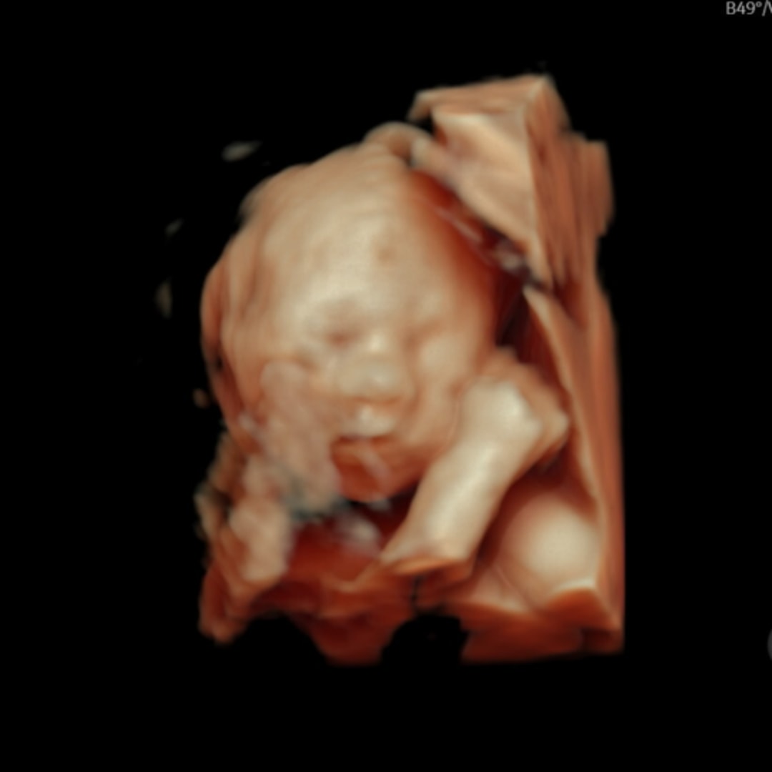 Photo shared by Keyoni for their Babylist baby registry.