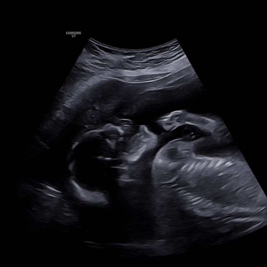 Photo shared by Estefania for their Babylist baby registry.