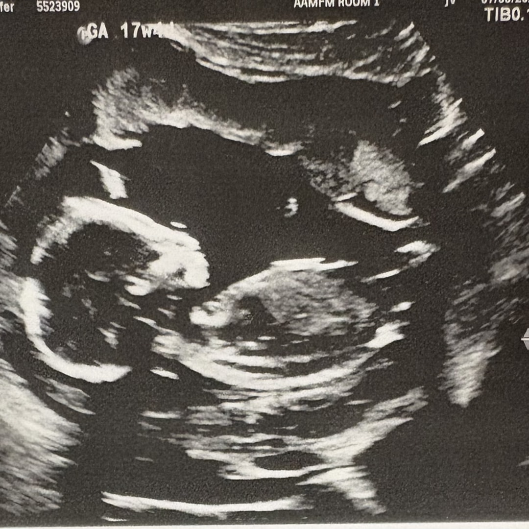 Photo shared by Jennifer for their Babylist baby registry.