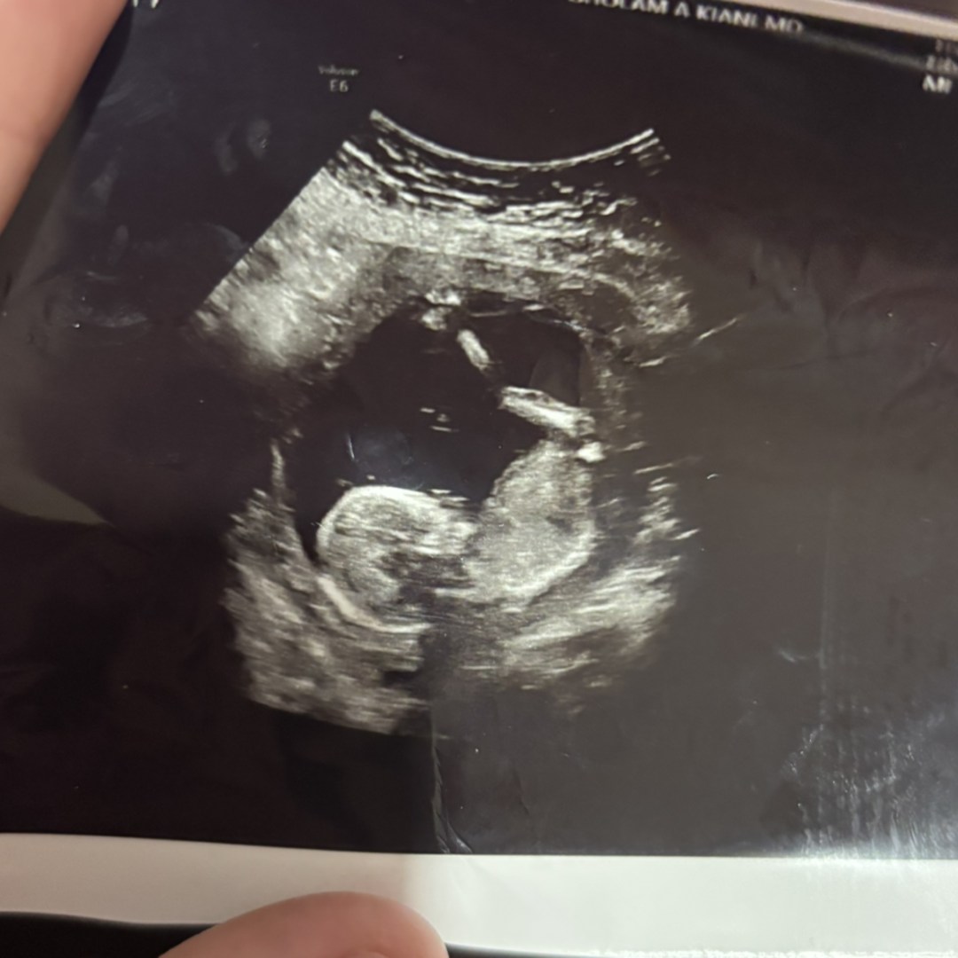 Photo shared by Gloria for their Babylist baby registry.