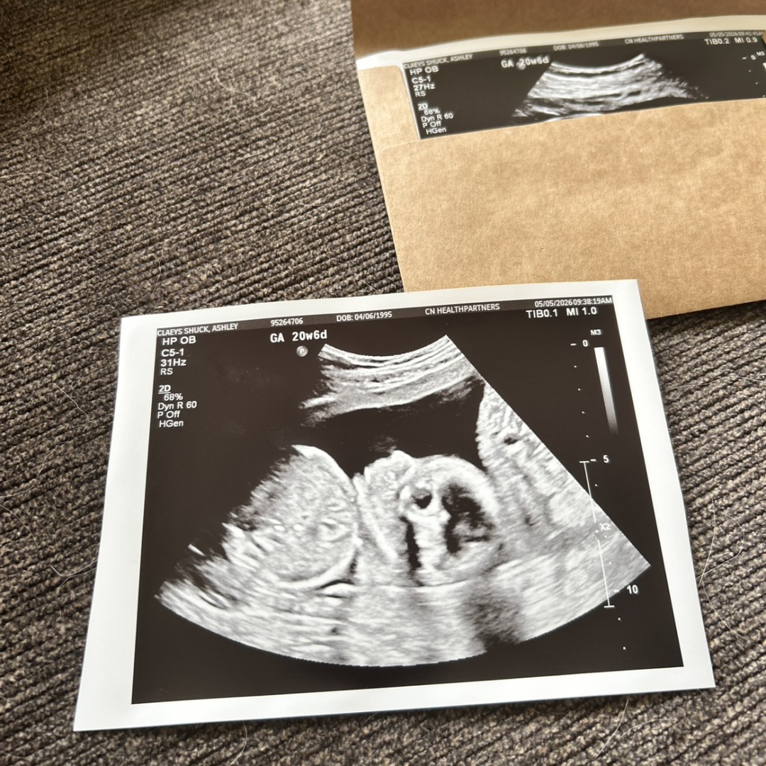Photo shared by Ashley for their Babylist baby registry.