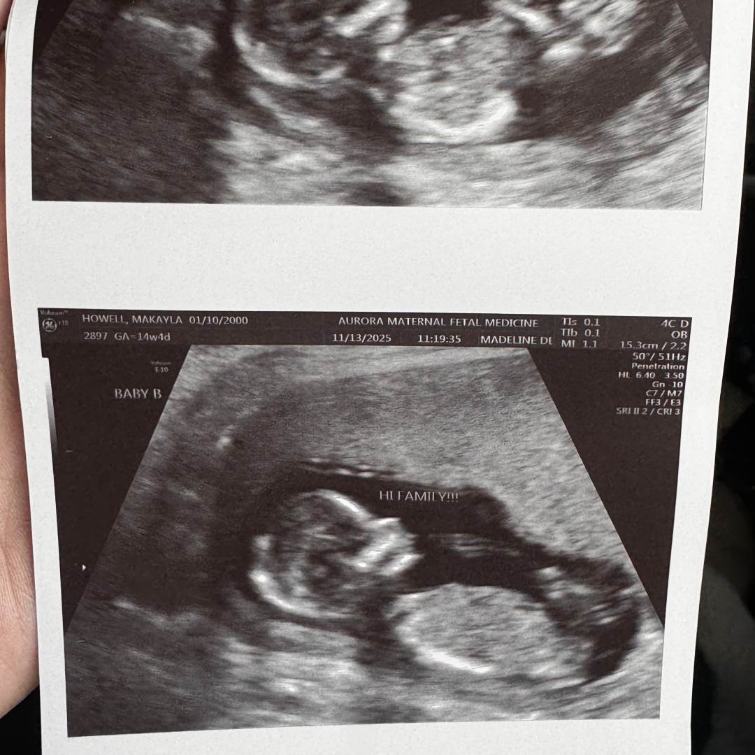 Photo shared by Makayla for their Babylist baby registry.