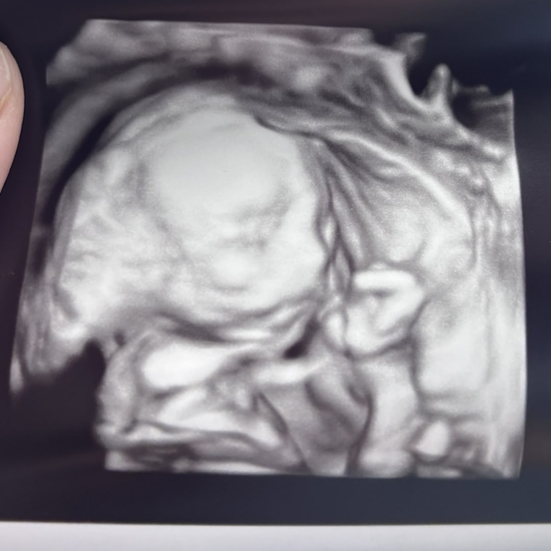 Photo shared by Isabelle for their Babylist baby registry.