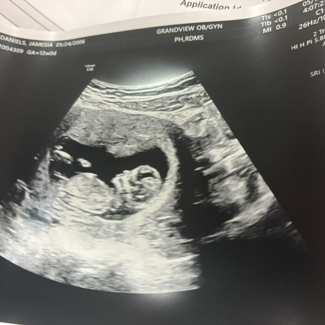 Photo shared by Jamesia for their Babylist baby registry.