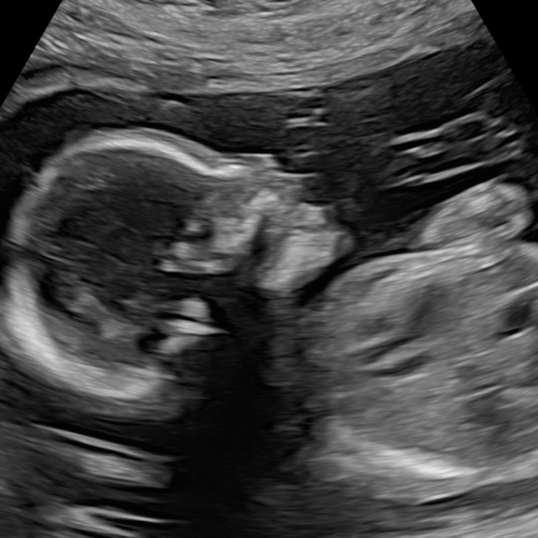 Photo shared by Brittany for their Babylist baby registry.