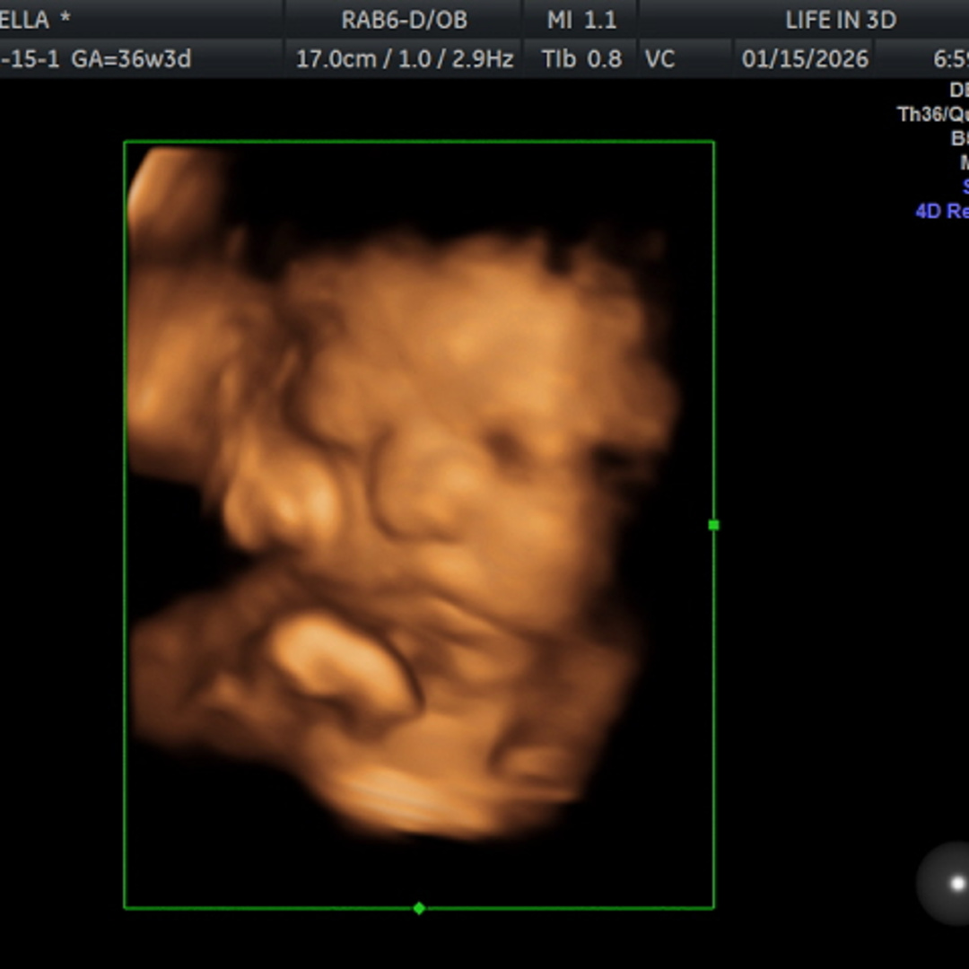 Photo shared by Gissella for their Babylist baby registry.