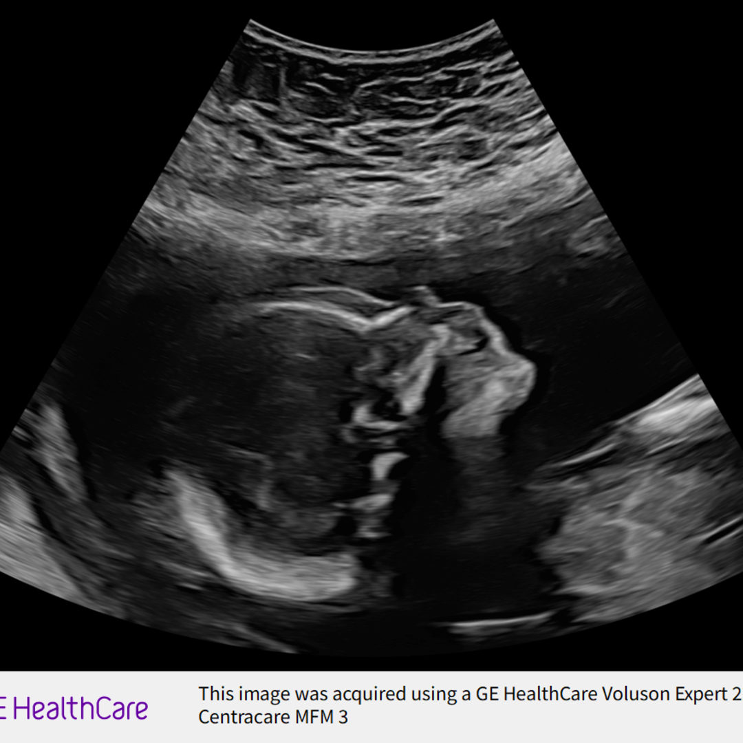 Photo shared by Amanda for their Babylist baby registry.