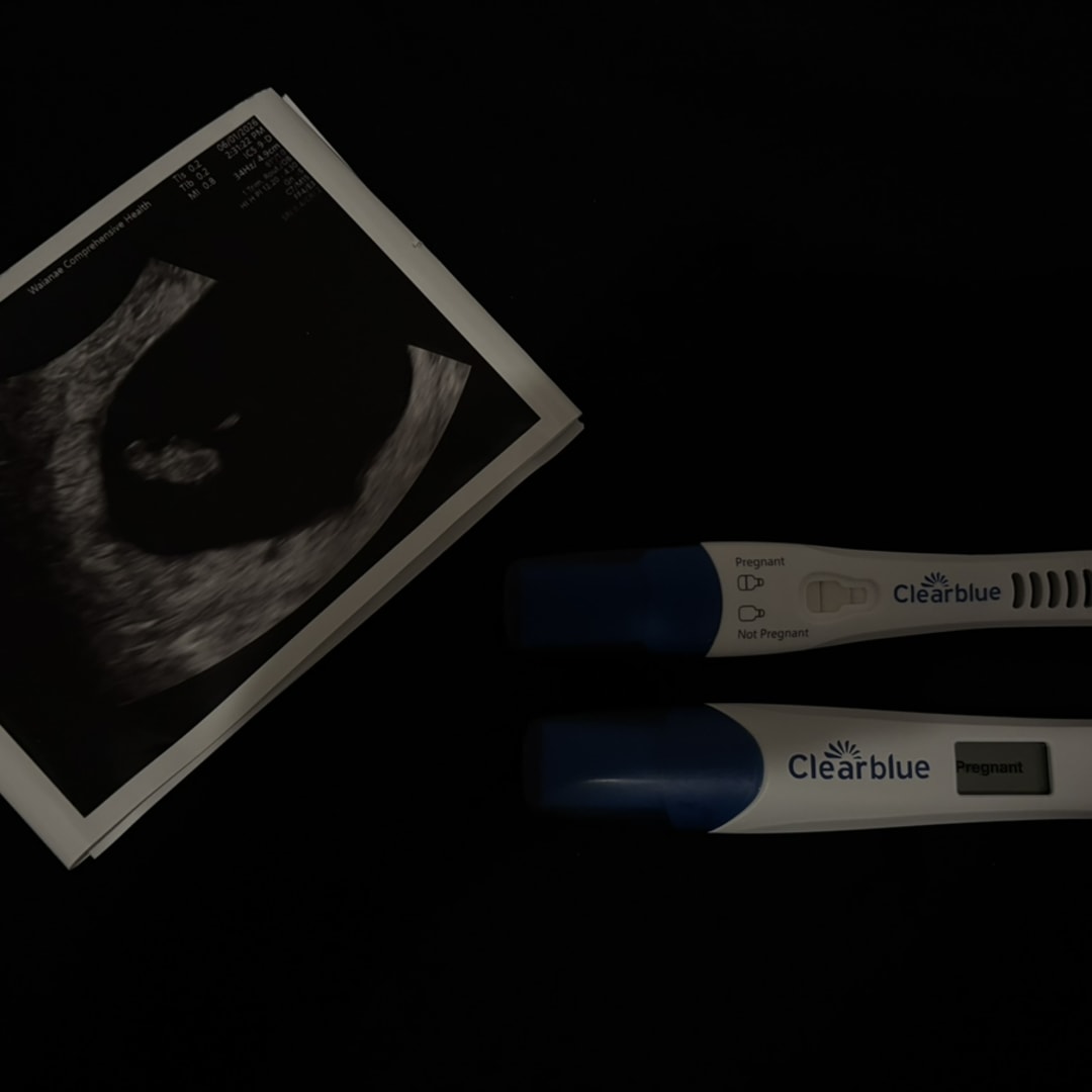 Photo shared by Kamalia for their Babylist baby registry.