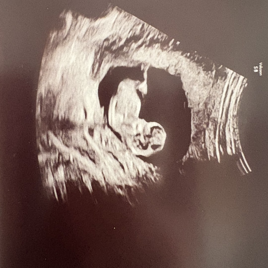 Photo shared by Haylee for their Babylist baby registry.