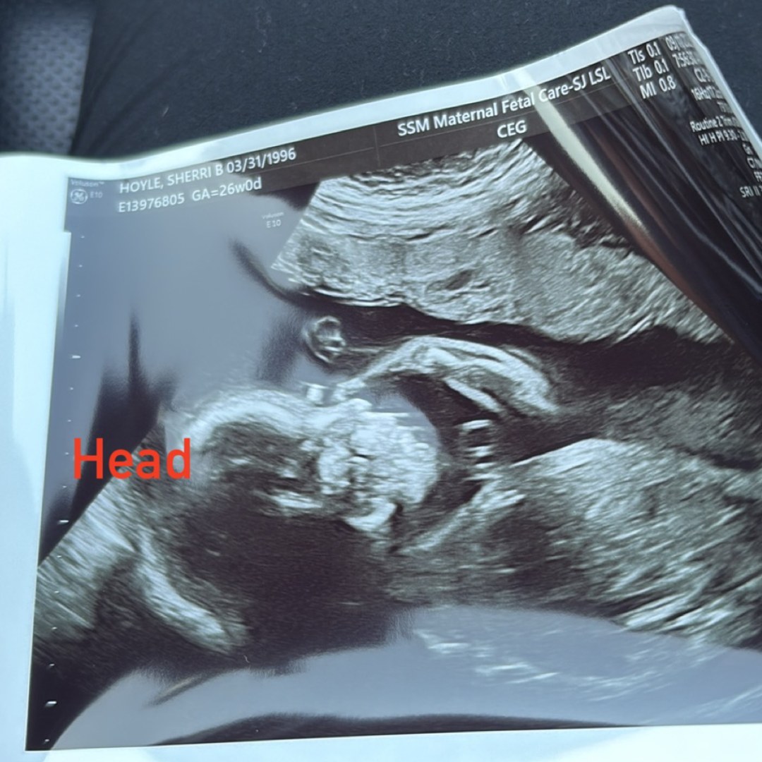 Photo shared by Sherri for their Babylist baby registry.